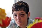 un adolescente de 14 años da una brutal paliza a una lesbiana en Canadá