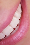 Blaqueador dental, ¿Cuál es el mejor método?