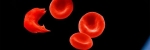 Cuáles son los síntomas de la anemia de células falciformes?