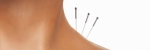 La acupuntura