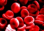 Causas de la anemia por deficiencia de hierro
