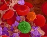 ¿Qué es la anemia aguda? 