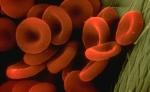 ¿Cuál es la anemia mediterránea? 
