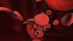 Síntomas y tipos de anemia