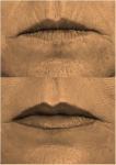 ¿Cómo tratar las arrugas del contorno de labios?