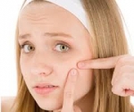 Acne Skin Care - Beauty Tips