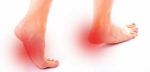Dolor de pies, posibles causas.Las patologías de los pies más comunes