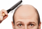 Como tratar los problemas de caída de cabello en el varón